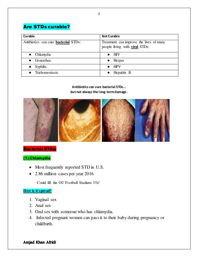 Sex Shop Usa Oral Sexually Transmitted Disease